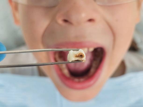 Best Pediatric Emergency Dentist in Westlake Vlage, IL