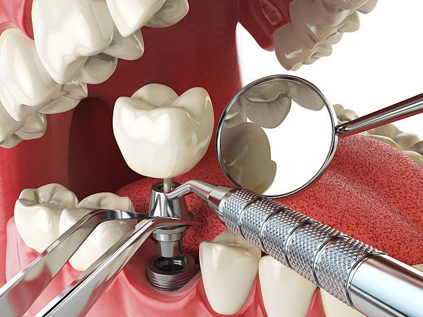 Best Emergency Dental Services for Seniors in Westlake Vlage, IL